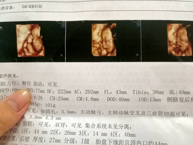 四维图片_24周照的,请帮忙看一下男女979797,谢谢959595