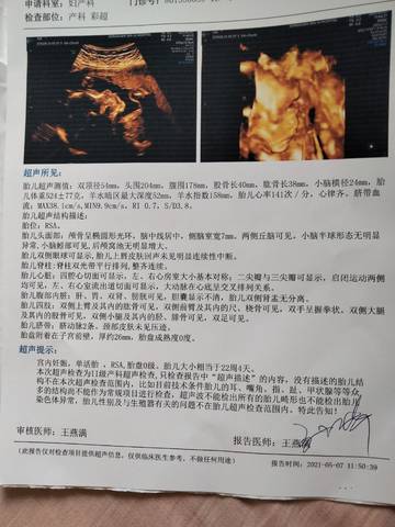 听说四维可以看出是男孩还是女孩 有没有能看懂的帮我看一下啊