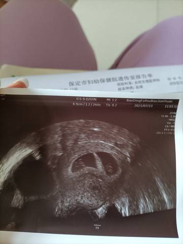 journal_insert_pic_1604157135