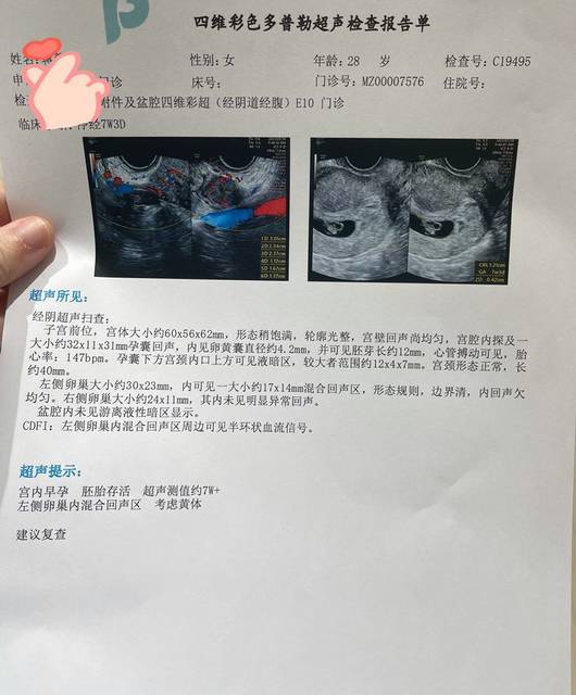 孕6和孕7周b超对比 昨天孕7加3的时候去做了b超，结果看到 宝宝树