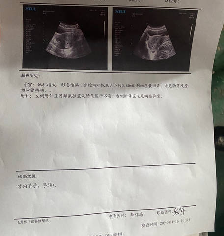 为什么附件会过期