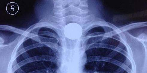 又一个孩子丧生,已致8名儿童身亡!马上检查家