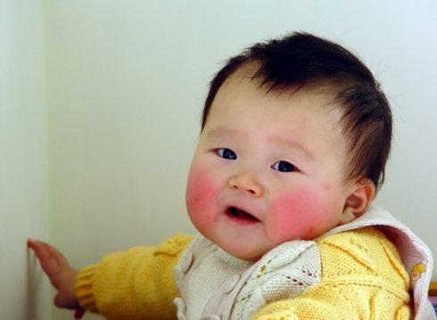 一到冬天宝宝的小脸就变成高原红,不要慌,这