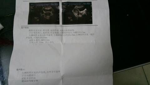 journal_insert_pic_542667113