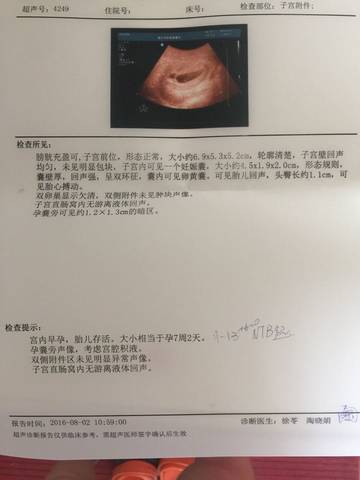 journal_insert_pic_542979899