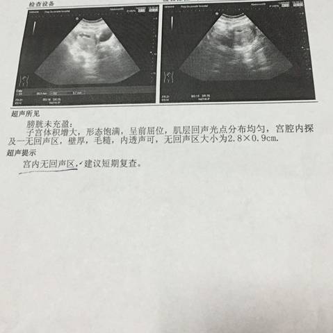 journal_insert_pic_545609609