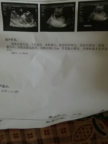 journal_insert_pic_545609352