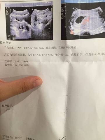 journal_insert_pic_547191776