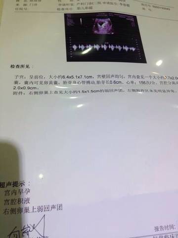 journal_insert_pic_547871544