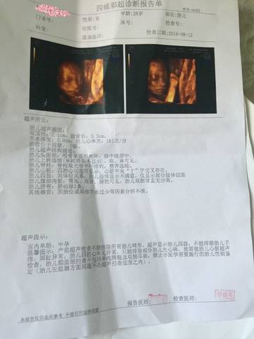 journal_insert_pic_549918706
