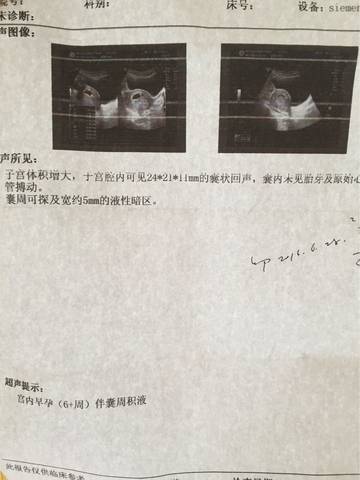 journal_insert_pic_550984784