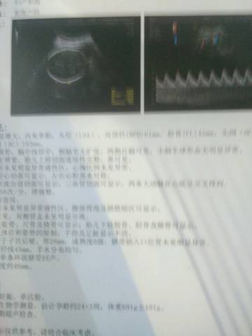 journal_insert_pic_552856331