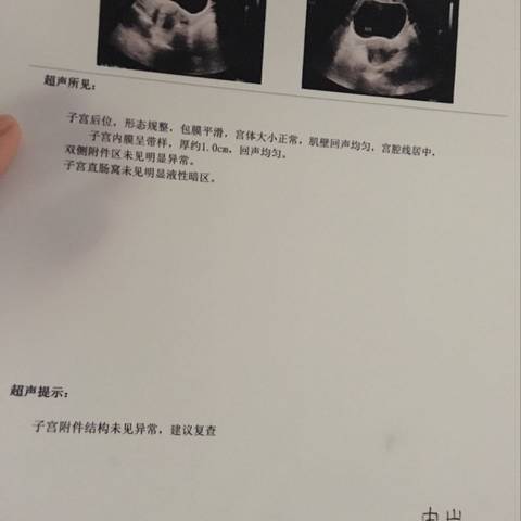 journal_insert_pic_554031794