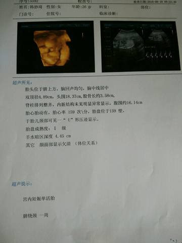 journal_insert_pic_553854471