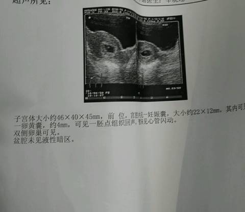 journal_insert_pic_555799106