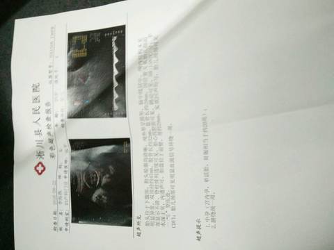 journal_insert_pic_556315469