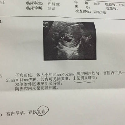 日照早孕检查医院