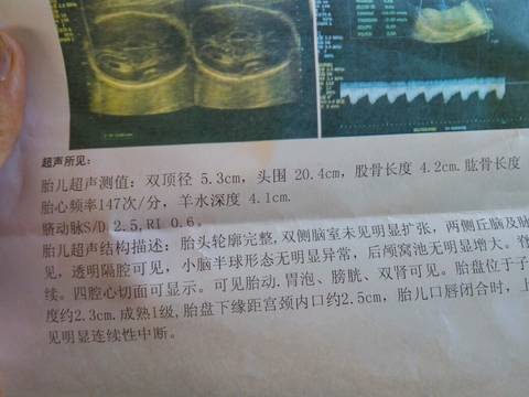 journal_insert_pic_558988809