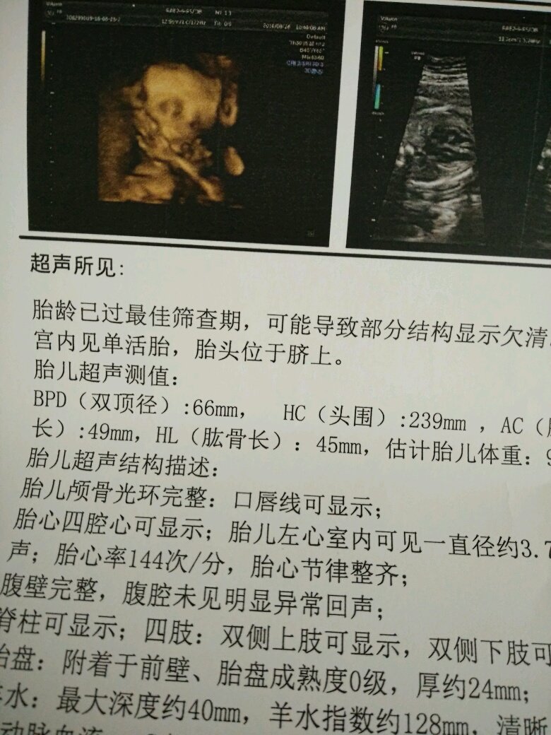 四维不是很清楚，是怎么回事？