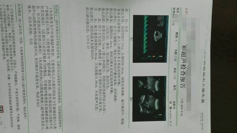 journal_insert_pic_559055534