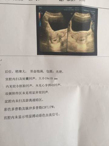 journal_insert_pic_560400700