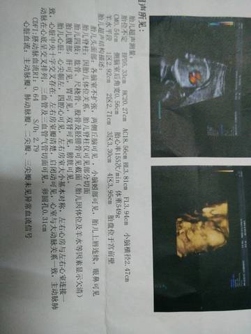 journal_insert_pic_560663487
