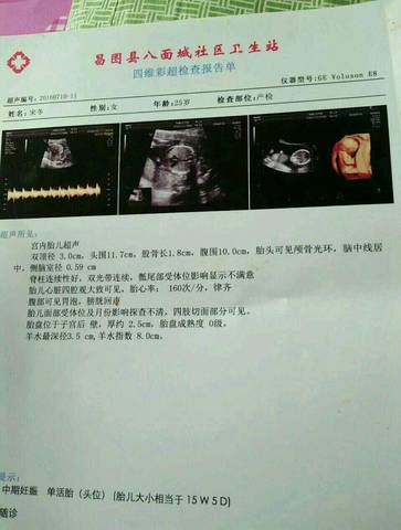 journal_insert_pic_561932274