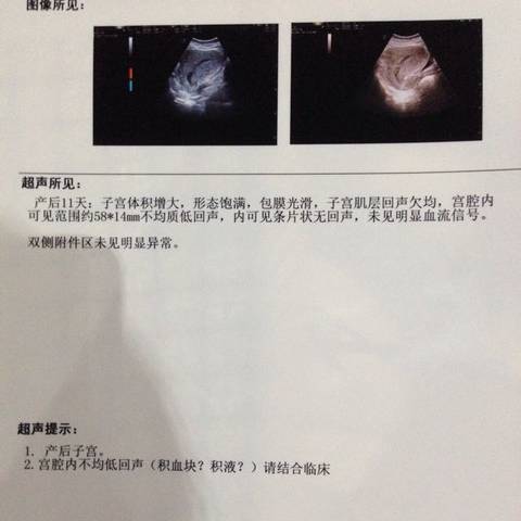 journal_insert_pic_561867755