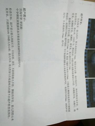 journal_insert_pic_562950430