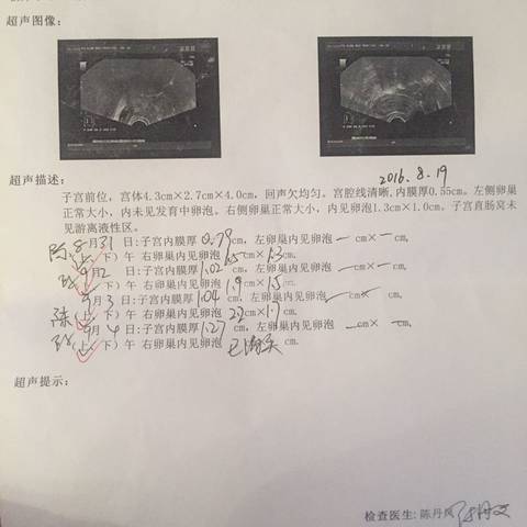 journal_insert_pic_565462280