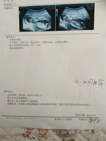 journal_insert_pic_567954349