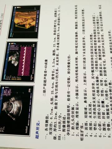 journal_insert_pic_568522249