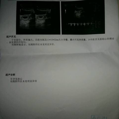 journal_insert_pic_568602432