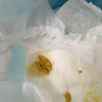 宝宝出生8天了,喂的奶粉,这样的大便正常吗