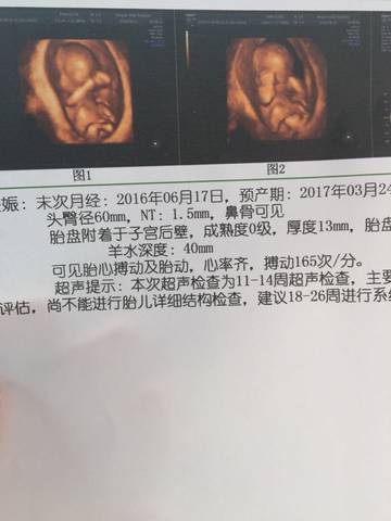 journal_insert_pic_570296027