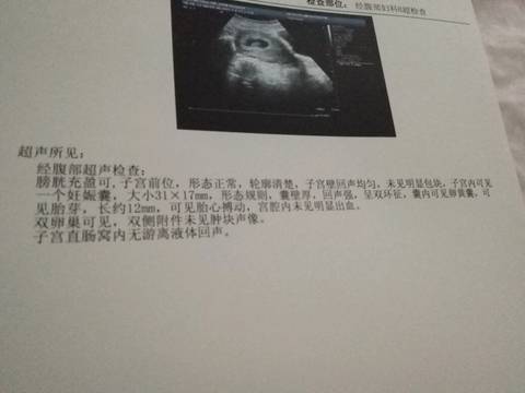 journal_insert_pic_571405602