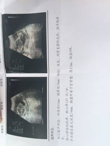 journal_insert_pic_572095813