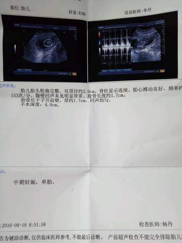 journal_insert_pic_573821290