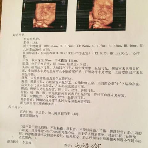 journal_insert_pic_574567414