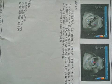 journal_insert_pic_574959839
