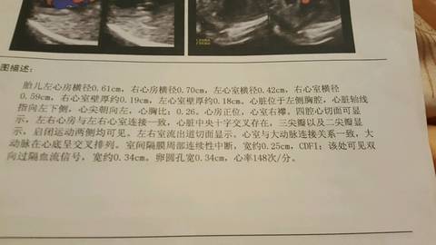 journal_insert_pic_575607311
