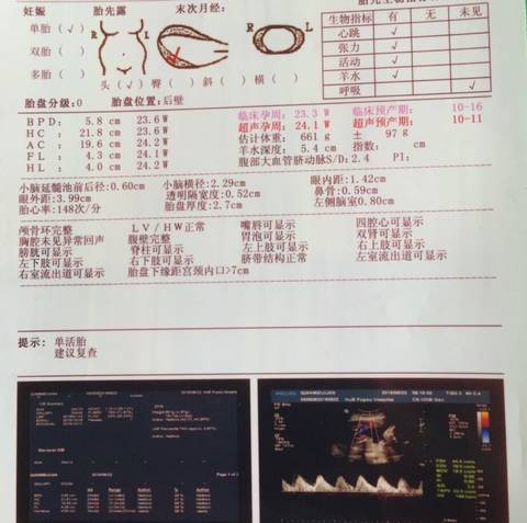journal_insert_pic_576200218