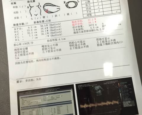 journal_insert_pic_576200223
