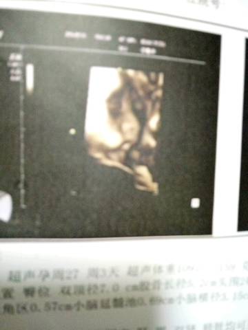 journal_insert_pic_578296286