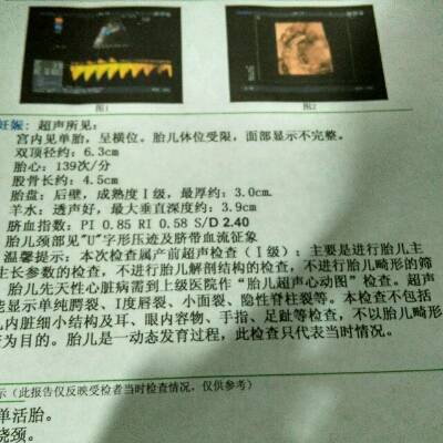 journal_insert_pic_578693227