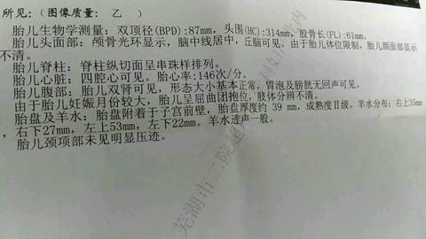 journal_insert_pic_579883170