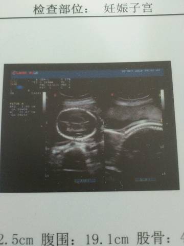 journal_insert_pic_581627332