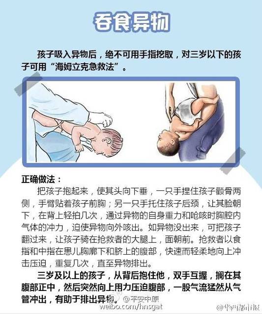 海姆立克急救法,沒人懂嗎