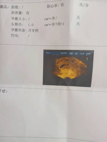 journal_insert_pic_583026697