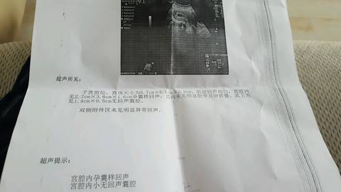 journal_insert_pic_583013481